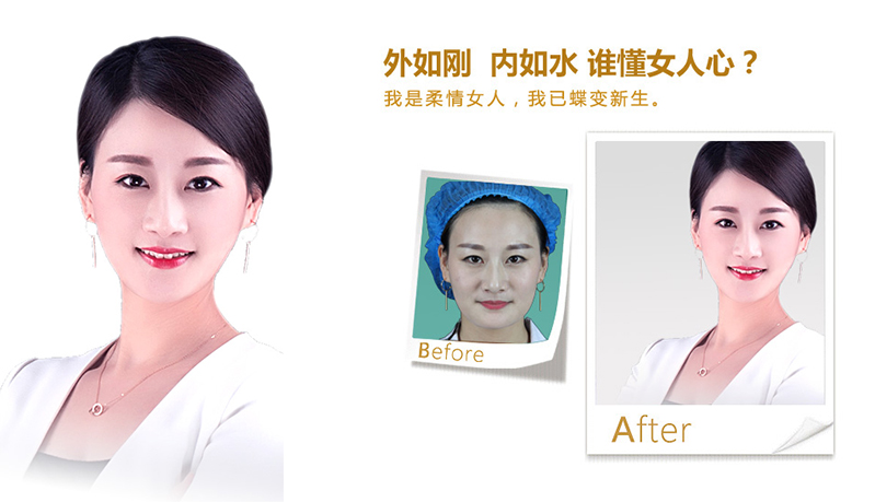 枣庄V脸、线雕隆鼻
